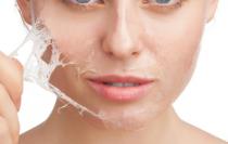 TOP 5 TIPS FOR DRY WINTER SKIN